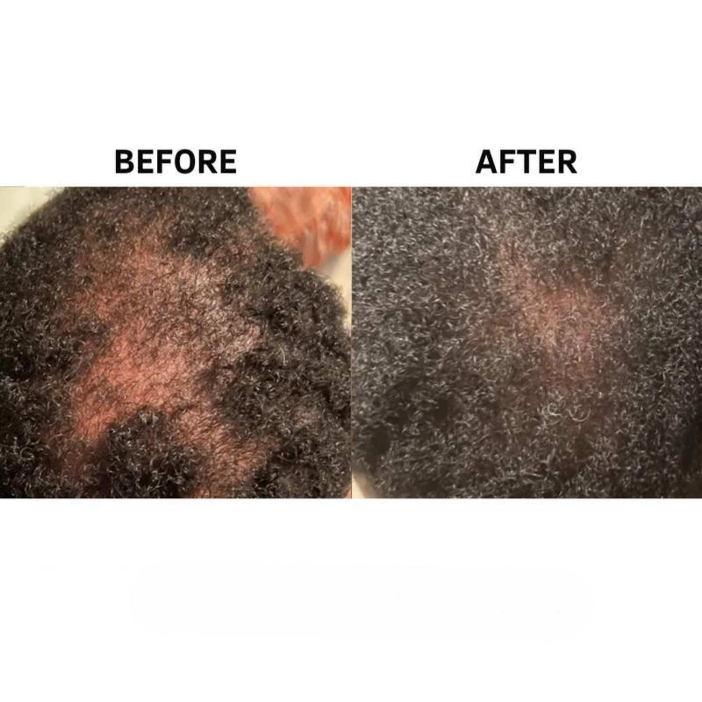 Stimulating Scalp and Hair Balm