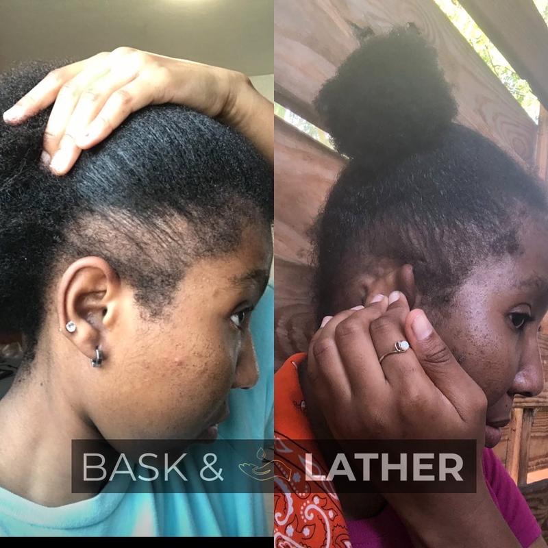 Scalp Stimulator Hair Growth Oil