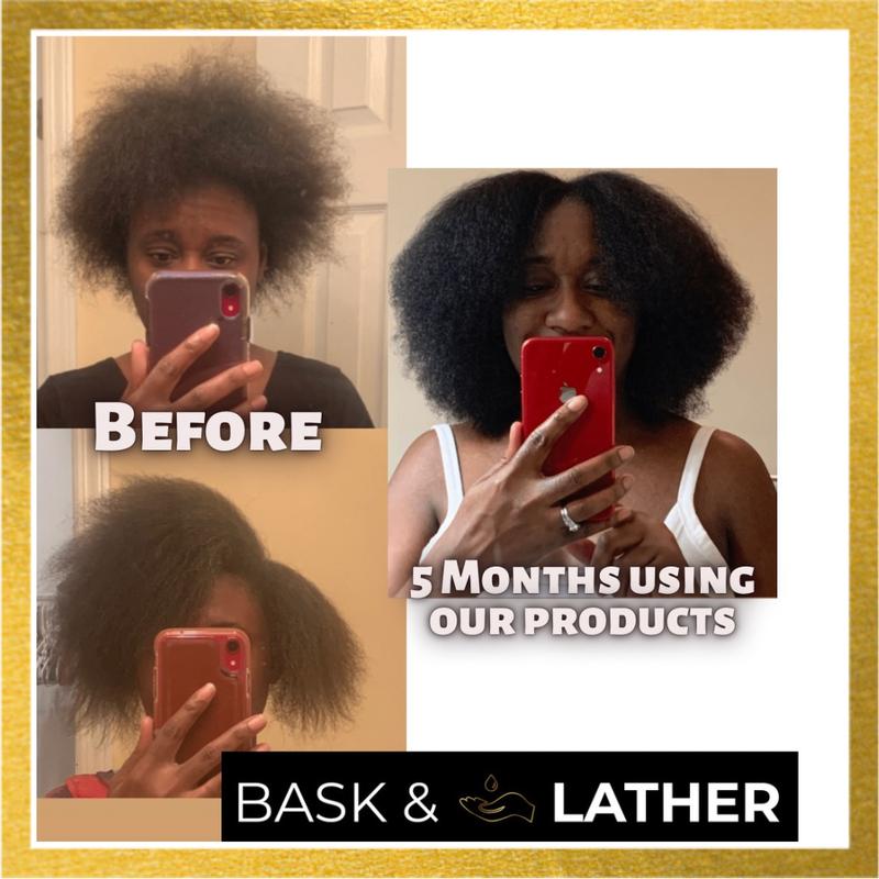 Scalp Stimulator Hair Growth Oil