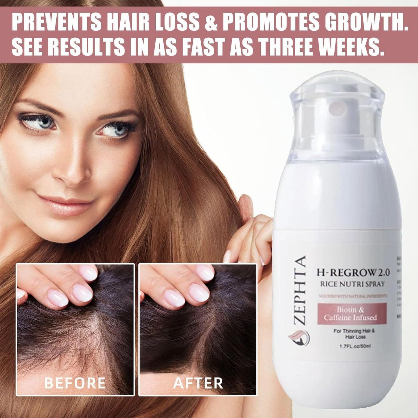 Hair Regrowth Rice Nourishing Spray