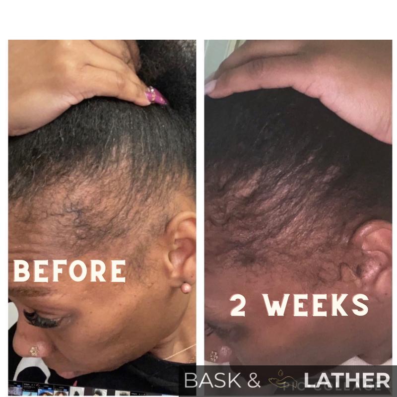 Scalp Stimulator Hair Growth Oil