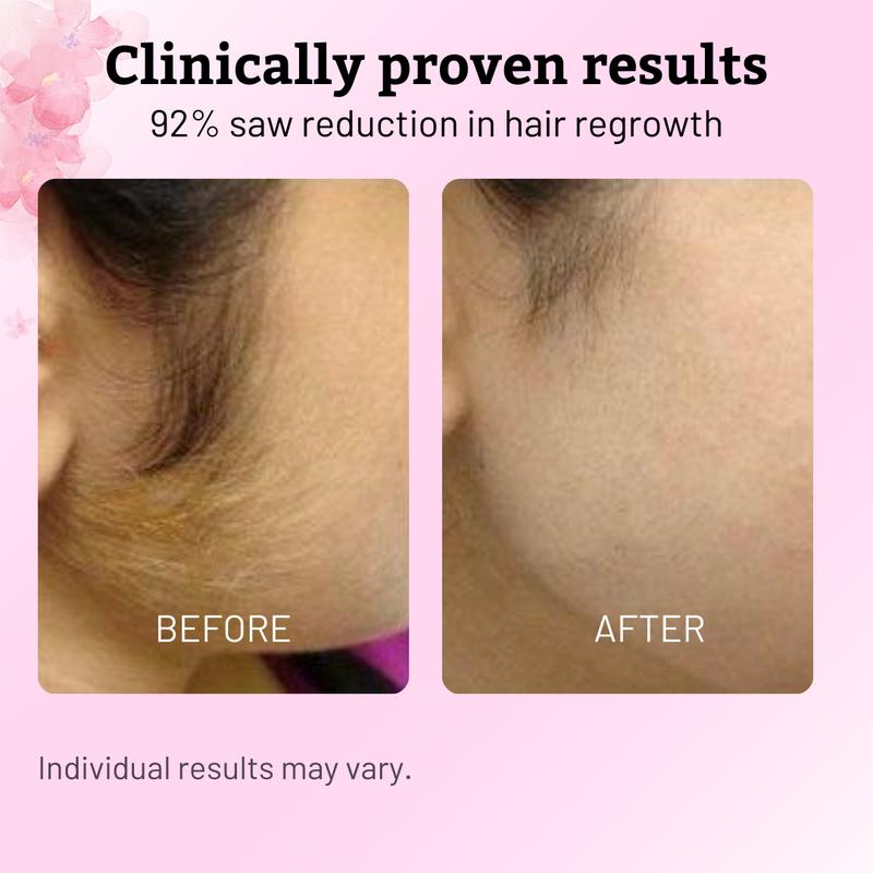 Caramela Beauty Cyperus Rotundus Oil for Hair Reduction