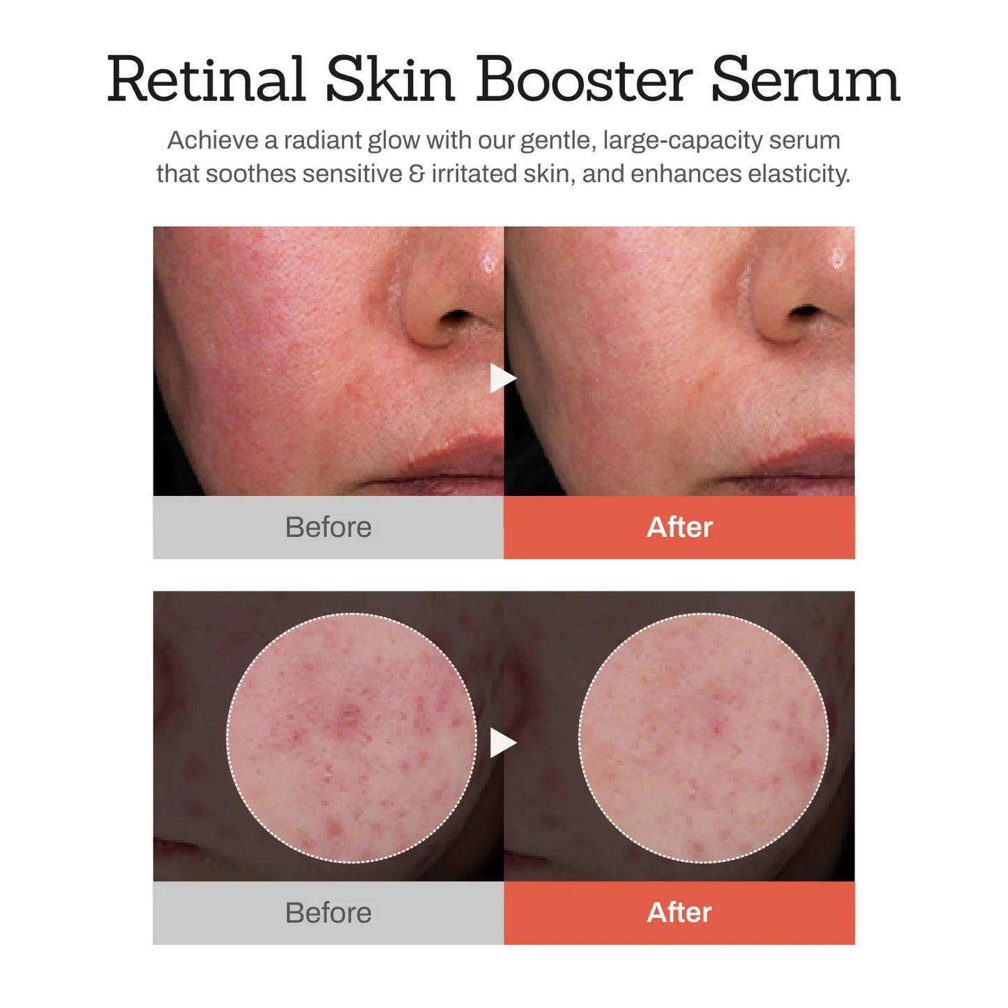 Retinal Skin Booster Serum