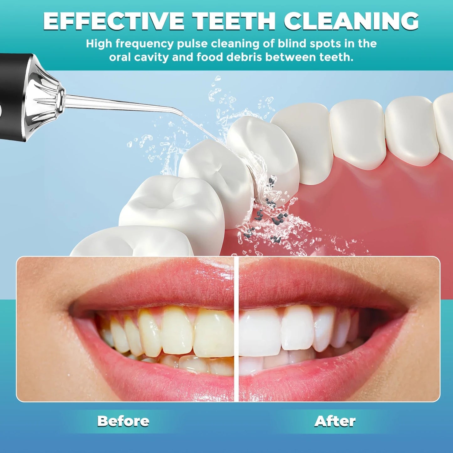 Ultimate Flosser
