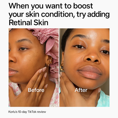 Retinal Skin Booster Serum