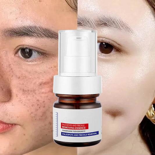 Dark Spot Dissapear Serum