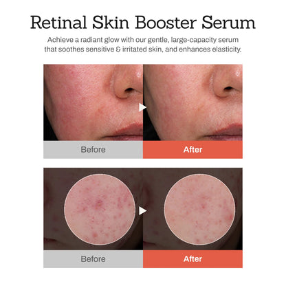 Retinal Skin Booster Serum