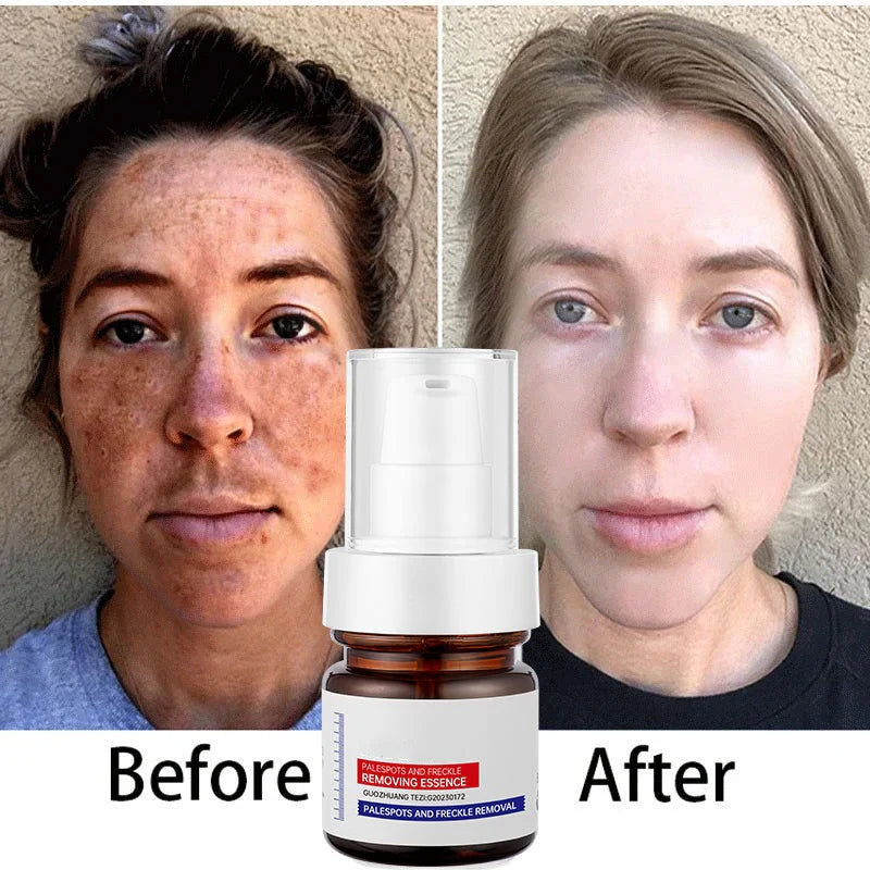 Dark Spot Dissapear Serum
