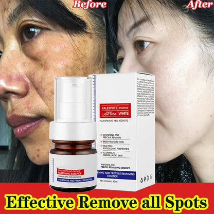 Dark Spot Dissapear Serum