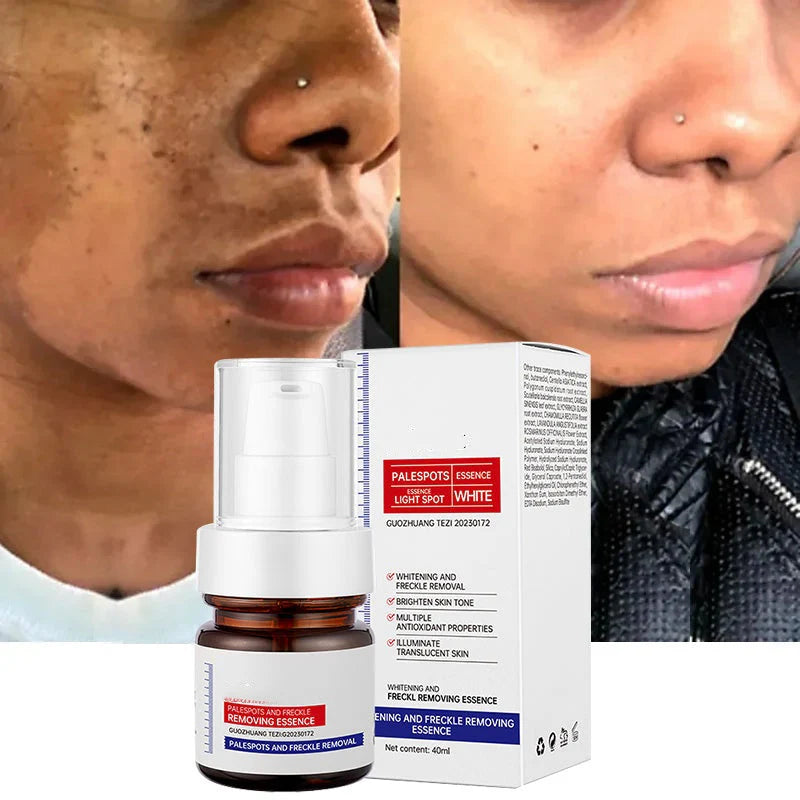 Dark Spot Dissapear Serum