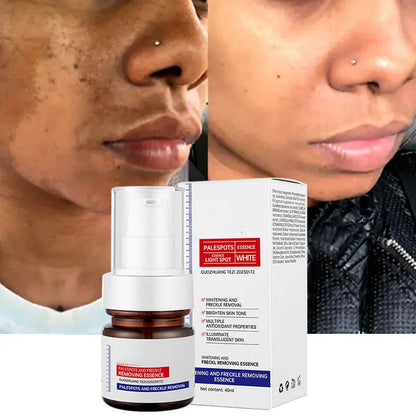 Dark Spot Dissapear Serum